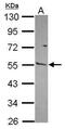 Matrix Metallopeptidase 13 antibody, PA5-27242, Invitrogen Antibodies, Western Blot image 