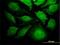 Thyroid Hormone Receptor Interactor 6 antibody, H00007205-M04, Novus Biologicals, Immunofluorescence image 