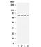 Integrin Subunit Beta 3 antibody, R31891, NSJ Bioreagents, Western Blot image 