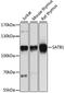 SATB Homeobox 1 antibody, STJ28364, St John