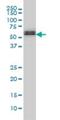 SMAD Family Member 5 antibody, H00004090-M01, Novus Biologicals, Western Blot image 