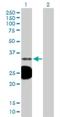 Testosterone 17-beta-dehydrogenase 3 antibody, H00003293-B01P, Novus Biologicals, Western Blot image 