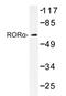 RAR Related Orphan Receptor A antibody, AP20414PU-N, Origene, Western Blot image 