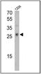 CD3d Molecule antibody, NBP2-22510, Novus Biologicals, Western Blot image 