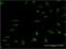 Mitogen-Activated Protein Kinase Kinase 5 antibody, H00005607-M01, Novus Biologicals, Immunocytochemistry image 