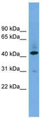 Beta-1,4-Galactosyltransferase 2 antibody, TA336173, Origene, Western Blot image 