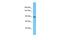 Immunoglobulin Superfamily Member 22 antibody, PA5-71123, Invitrogen Antibodies, Western Blot image 