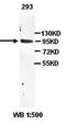 Tropomyosin 4 antibody, orb77368, Biorbyt, Western Blot image 