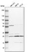 Proteasome 26S Subunit, Non-ATPase 10 antibody, PA5-51776, Invitrogen Antibodies, Western Blot image 