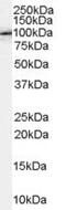 Amyloid Beta Precursor Protein Binding Family B Member 1 antibody, NB100-41392, Novus Biologicals, Western Blot image 