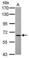 Acyl-CoA Thioesterase 11 antibody, GTX119129, GeneTex, Western Blot image 