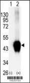 Branched Chain Keto Acid Dehydrogenase Kinase antibody, 62-652, ProSci, Western Blot image 