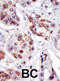 Phosphatidylinositol-5-Phosphate 4-Kinase Type 2 Gamma antibody, abx033839, Abbexa, Western Blot image 