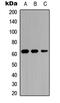Interleukin 20 Receptor Subunit Alpha antibody, MBS8226292, MyBioSource, Western Blot image 