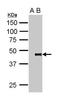 Pygopus Family PHD Finger 2 antibody, PA5-31553, Invitrogen Antibodies, Immunoprecipitation image 