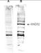 RAD52 Homolog, DNA Repair Protein antibody, orb86650, Biorbyt, Western Blot image 