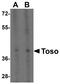 Fc Fragment Of IgM Receptor antibody, A09423, Boster Biological Technology, Western Blot image 