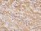 RNA Polymerase III Subunit H antibody, 205125-T10, Sino Biological, Immunohistochemistry frozen image 