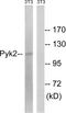 Protein Tyrosine Kinase 2 Beta antibody, LS-C199505, Lifespan Biosciences, Western Blot image 