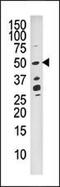 Dual Specificity Phosphatase 10 antibody, MBS9213379, MyBioSource, Western Blot image 