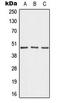 A-Kinase Anchoring Protein 5 antibody, LS-B13647, Lifespan Biosciences, Western Blot image 
