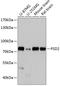 Pleckstrin And Sec7 Domain Containing 2 antibody, A12531, Boster Biological Technology, Western Blot image 