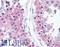 Mitogen-Activated Protein Kinase 1 antibody, LS-B1633, Lifespan Biosciences, Immunohistochemistry frozen image 
