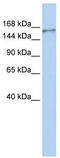 Neurobeachin Like 1 antibody, TA344040, Origene, Western Blot image 