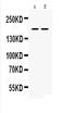 Transient Receptor Potential Cation Channel Subfamily M Member 1 antibody, A03565-1, Boster Biological Technology, Western Blot image 