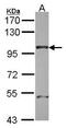 Nucleoporin 98 antibody, GTX114157, GeneTex, Western Blot image 