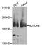 Notch Receptor 4 antibody, A8303, ABclonal Technology, Western Blot image 