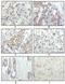 Ribosomal Protein S6 Kinase A1 antibody, abx011489, Abbexa, Enzyme Linked Immunosorbent Assay image 