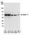 Septin 11 antibody, A304-177A, Bethyl Labs, Western Blot image 