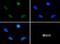 Baculoviral IAP Repeat Containing 5 antibody, NB500-236, Novus Biologicals, Immunocytochemistry image 