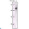 Keratin 5 antibody, LS-C812437, Lifespan Biosciences, Immunofluorescence image 