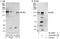 Inhibitor Of Bruton Tyrosine Kinase antibody, A303-001A, Bethyl Labs, Immunoprecipitation image 