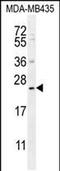 PH Domain Containing Endocytic Trafficking Adaptor 1 antibody, PA5-48339, Invitrogen Antibodies, Western Blot image 