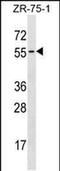 Transcobalamin 1 antibody, PA5-49164, Invitrogen Antibodies, Western Blot image 