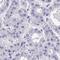 Olfactory Receptor Family 4 Subfamily C Member 5 (Gene/Pseudogene) antibody, HPA049516, Atlas Antibodies, Immunohistochemistry paraffin image 