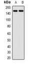 Sodium Voltage-Gated Channel Beta Subunit 3 antibody, orb376706, Biorbyt, Western Blot image 