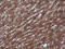 Rhotekin antibody, M07596-1, Boster Biological Technology, Immunohistochemistry paraffin image 