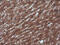 RTKN antibody, M07596-1, Boster Biological Technology, Immunohistochemistry paraffin image 