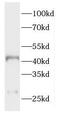 HAUS Augmin Like Complex Subunit 4 antibody, FNab03764, FineTest, Western Blot image 
