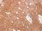 Glutathione S-Transferase Omega 1 antibody, GTX118439, GeneTex, Immunohistochemistry paraffin image 