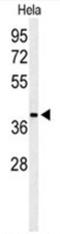 ADP-Ribosylhydrolase Like 2 antibody, AP50098PU-N, Origene, Western Blot image 