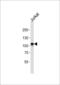 MER Proto-Oncogene, Tyrosine Kinase antibody, 63-251, ProSci, Western Blot image 