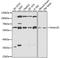 SWI/SNF-related matrix-associated actin-dependent regulator of chromatin subfamily D member 1 antibody, STJ111991, St John