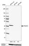 ATPase H+ Transporting Accessory Protein 2 antibody, NBP1-90820, Novus Biologicals, Western Blot image 