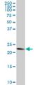 Trafficking Protein Particle Complex 4 antibody, H00051399-M03, Novus Biologicals, Western Blot image 