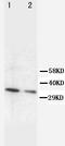 Cyclin D2 antibody, PA1225, Boster Biological Technology, Western Blot image 